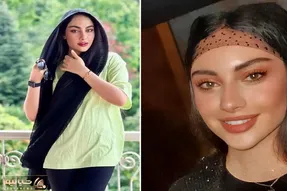 ترلان پروانه انگاری خودش فیسشو تو مواد میخوابونه؛ خانوم ته هر چی عمل مملِ در آورده!