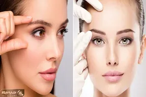 بالا بردن ابروها بدون جراحی / فاصله ی چشم و ابروت که زیاد بشه تازه آرایشت به چشم میاد