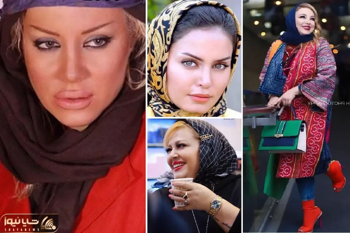 بازیگران زنی که تَه عمل ممل نون کشیدن؛ دماغو کوبیدن بینی تحویل گرفتن حتی شده سه باررر!