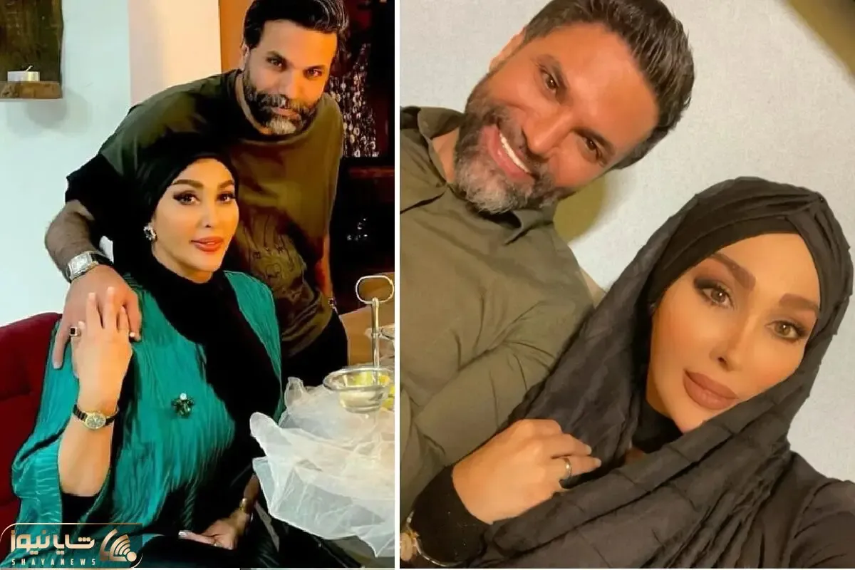 تغییر چهره فاحش و بدیع علیرضا نیکبخت واسه مدلینگ؛ استایل پربوتاکس همسرش با یه کامیون ژل
