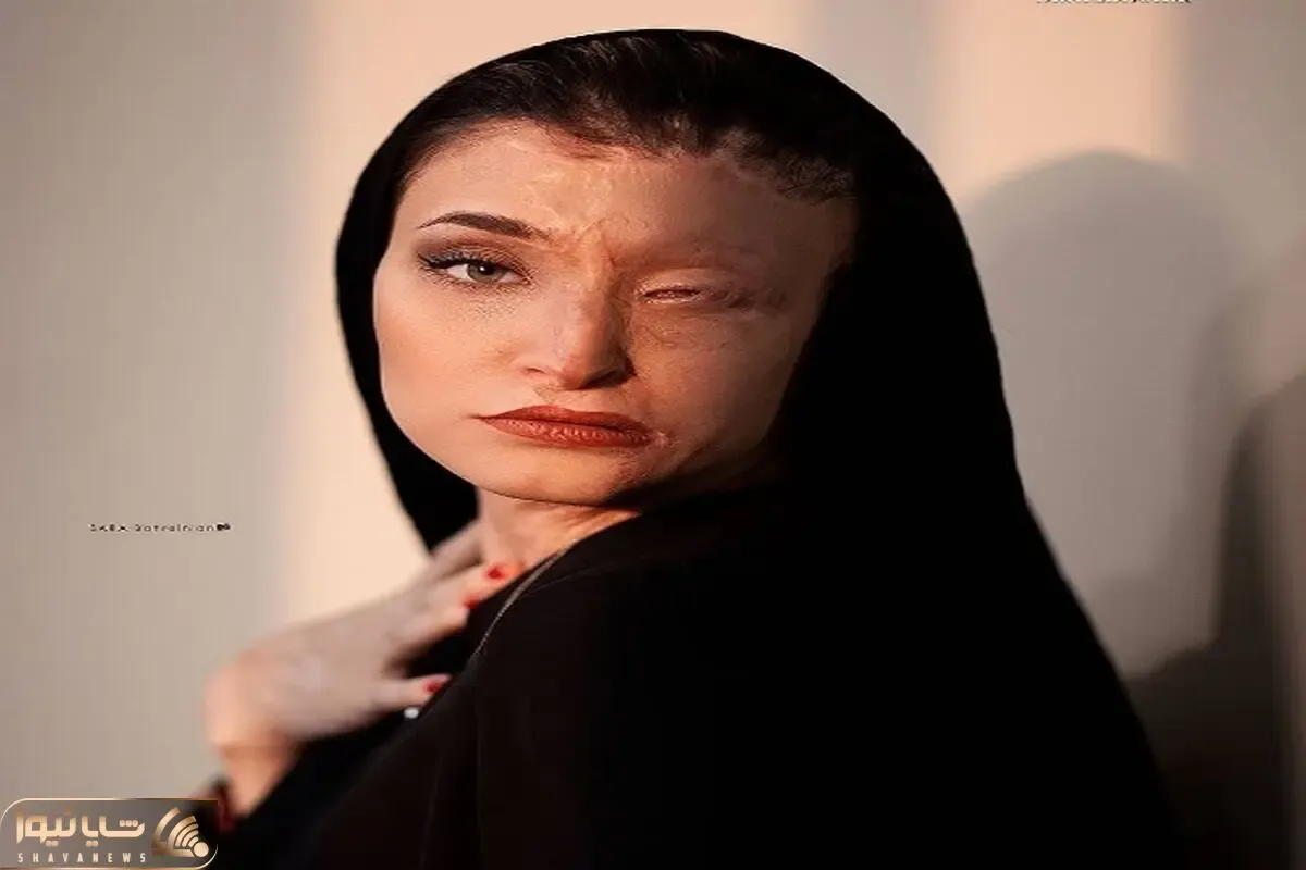 عکسی که مرضیه ابراهیمی منتشر کرد و جنجالی شد