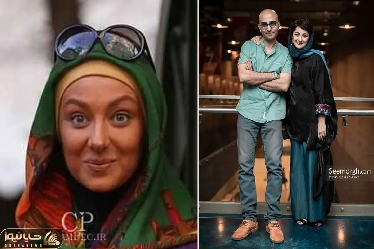 قبل و بعد ویدا جوان / با پژی گفتنش تو پژمان حرص دربیار بود حالا شده گوزل بازیگرا