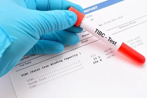 تست TIBC آزمایش خون چیست؟