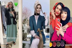 تغییر چهره فاحش متین ستوده با حجم پروتزی که تزریق کرد؛ پاشنه پاش نیست ولی انقدر بلنده!