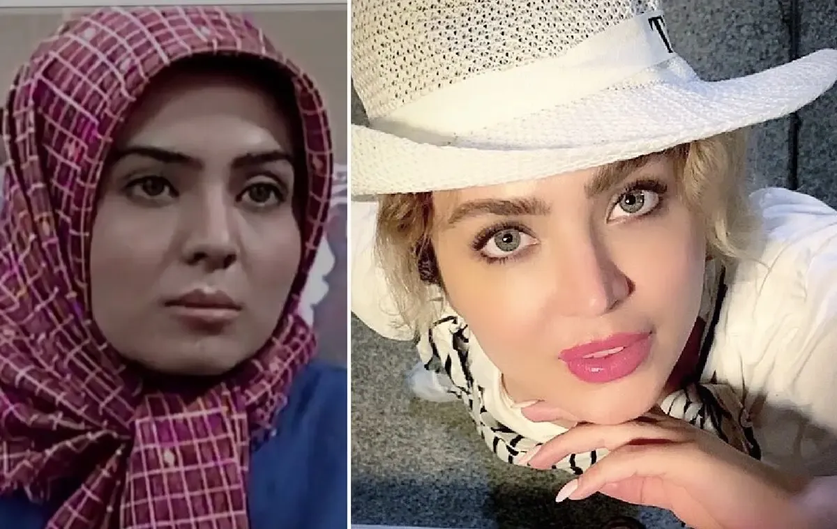 زیبایی 