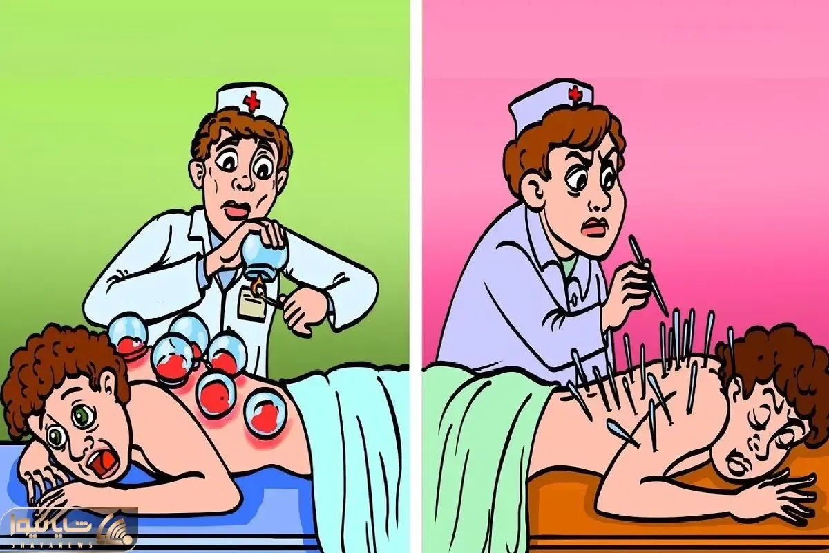 هوش تصویری؛ اگه فکر میکنی تیز هوشی بگو کدوم از این آقایون که حجامت می کنند قاتلن؟