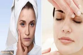 چگونه بند بندازیم که جوش نزنیم؟ / اینجوری میتونی قرمزی و تورم بعدش رو هم از بین ببری