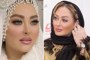 عمل بینی 