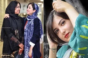 زیبا کرمعلی رفت خوشگلاسیون اما یه جور شده ناجور؛ خانوم بعد دینامیت چه فوکولی شده!