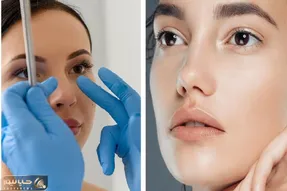 مناسب ترین عمل زیبایی بینی برای شما؛ هر فرم صورت با چه مدل بینی خوب میشه