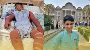 دستور ویژه وزیر برای مداوای علی لندی پسر فداکار دهه هشتادی