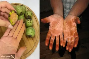 از بین بردن رنگ پوست گردو از دست/ تو فقط فک کن قرار داشته باشی با دست سیاه بری واویلا
