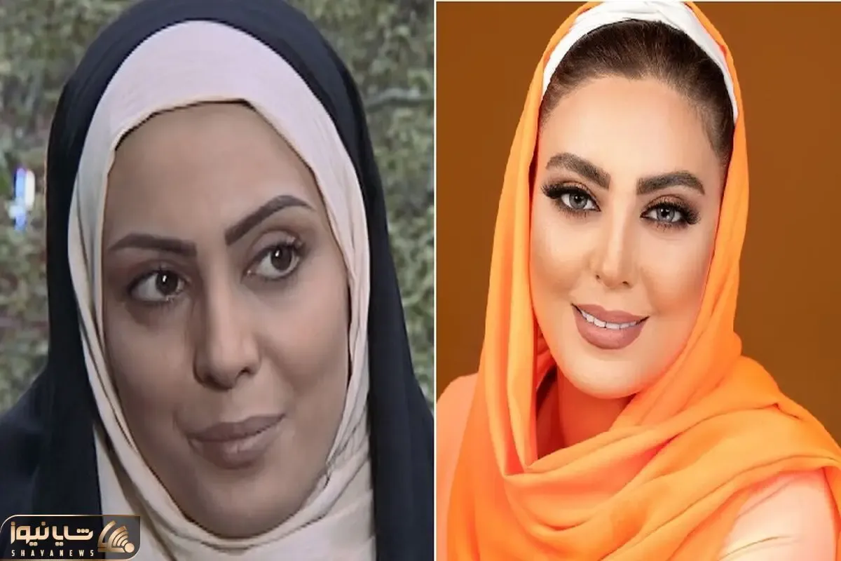 عمل بینی نیلوفر شهیدی / دختر ساده به کجا چنین شتابان بعد سریال چه شتافت اروپا