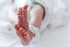 تولد نوزادی عجیب با سه آلت تناسلی!