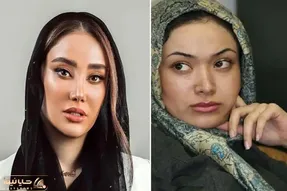 نیو فیس سازی بهاره افشاری بعد از ۱۴ سال/ بیتای فاصله ها یا زنی که دو چهره دارد؟!