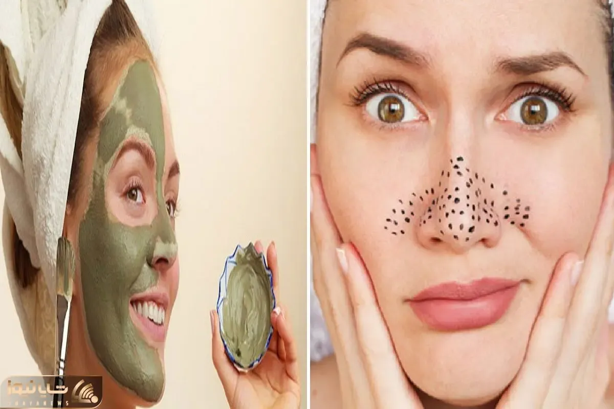 از بین بردن جوشای سر سیاه بینی در خانه / خرج رو دست خودت نذار با صابون و نمک آینه اس