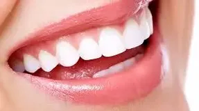 راه های خانگی و کم خرج سفید کردن دندان ها