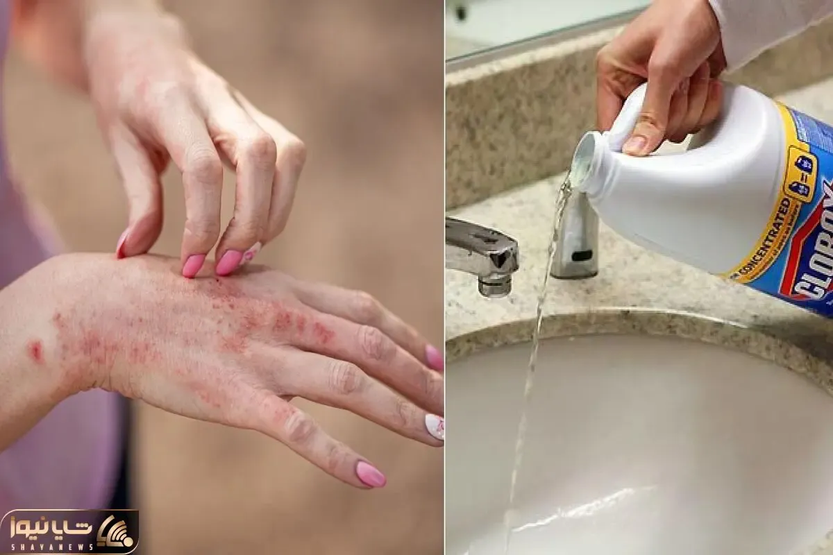 بهترین جایگزین ها به جای وایتکس / نه دستات داغون میشه نه لباس کثیف میشه نه مضره