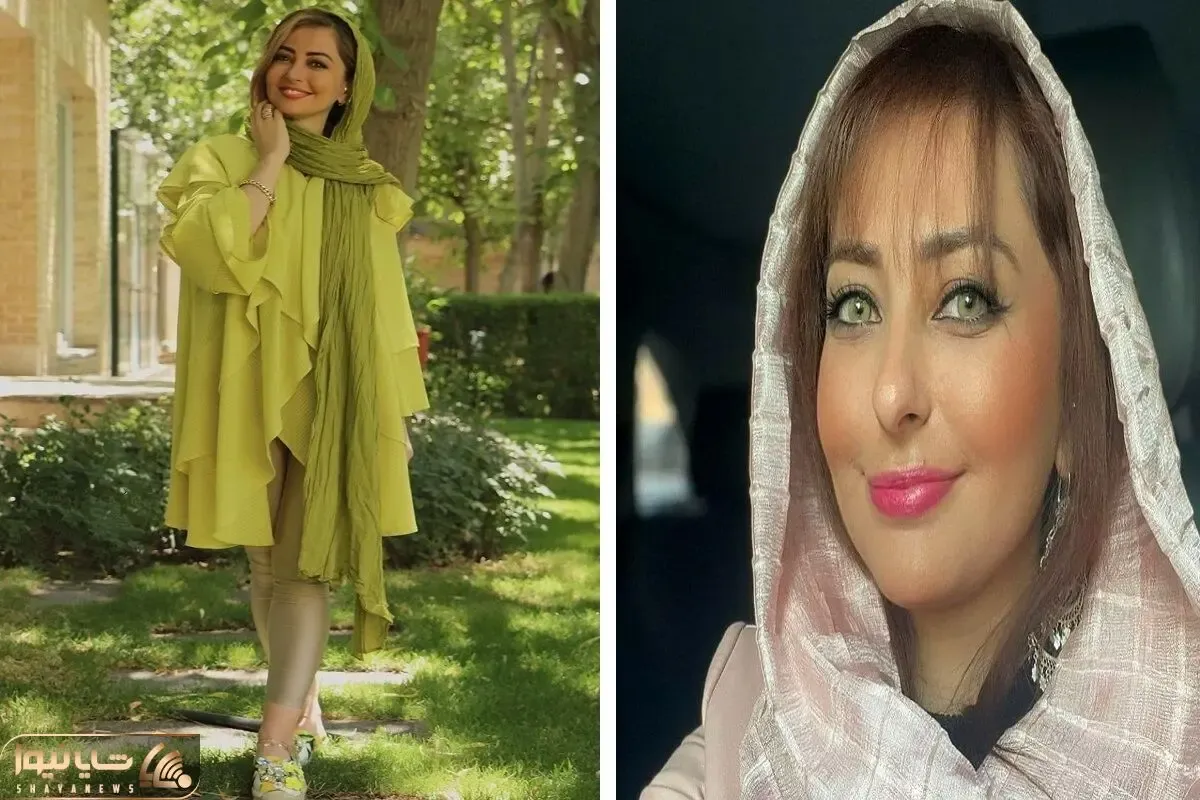 لباس سر تا پا طلاکوب 