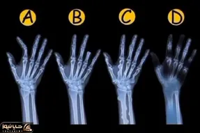 بازی فکری؛ مغز پلیست رو به کار بکش و بگو کدوم از این MRI برای جسد؟