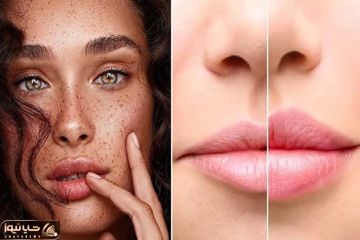 قد دو تا نخ لب داری و جیبتم کفاف پروتز لب نمیده؟ خب خونگی لباتو بزرگ کن اونم بی دردسر