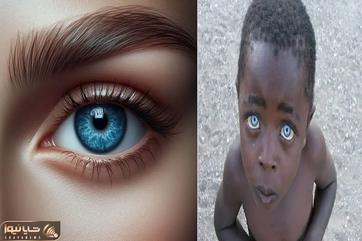 رنگین کمان چشم‌ها؛ دوست داری چشم بچه‌ات چه رنگی باشه؟