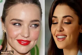 چیکار کنیم چال گونه داشته باشیم؟ / عملو ولش با روشای طبیعی این زیبایی رو به صورت ببخش