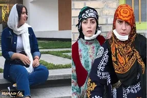 فِیس متفاوت روناک نون خ / صهبا شرافتی تو سوشال مدیا با گونه های عمل کرده امروزی