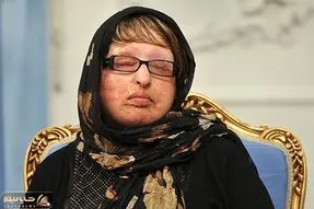 آمنه بهرامی؛ قربانی معروف اسیدپاشی بعد از ۱۸ سال دوباره شکایت کرد