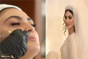 دنیای بازیگران؛ تزریقات زیبایی مریم مومن قبل از عروس شدن