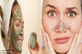 از بین بردن جوشای سر سیاه بینی در خانه / خرج رو دست خودت نذار با صابون و نمک آینه اس