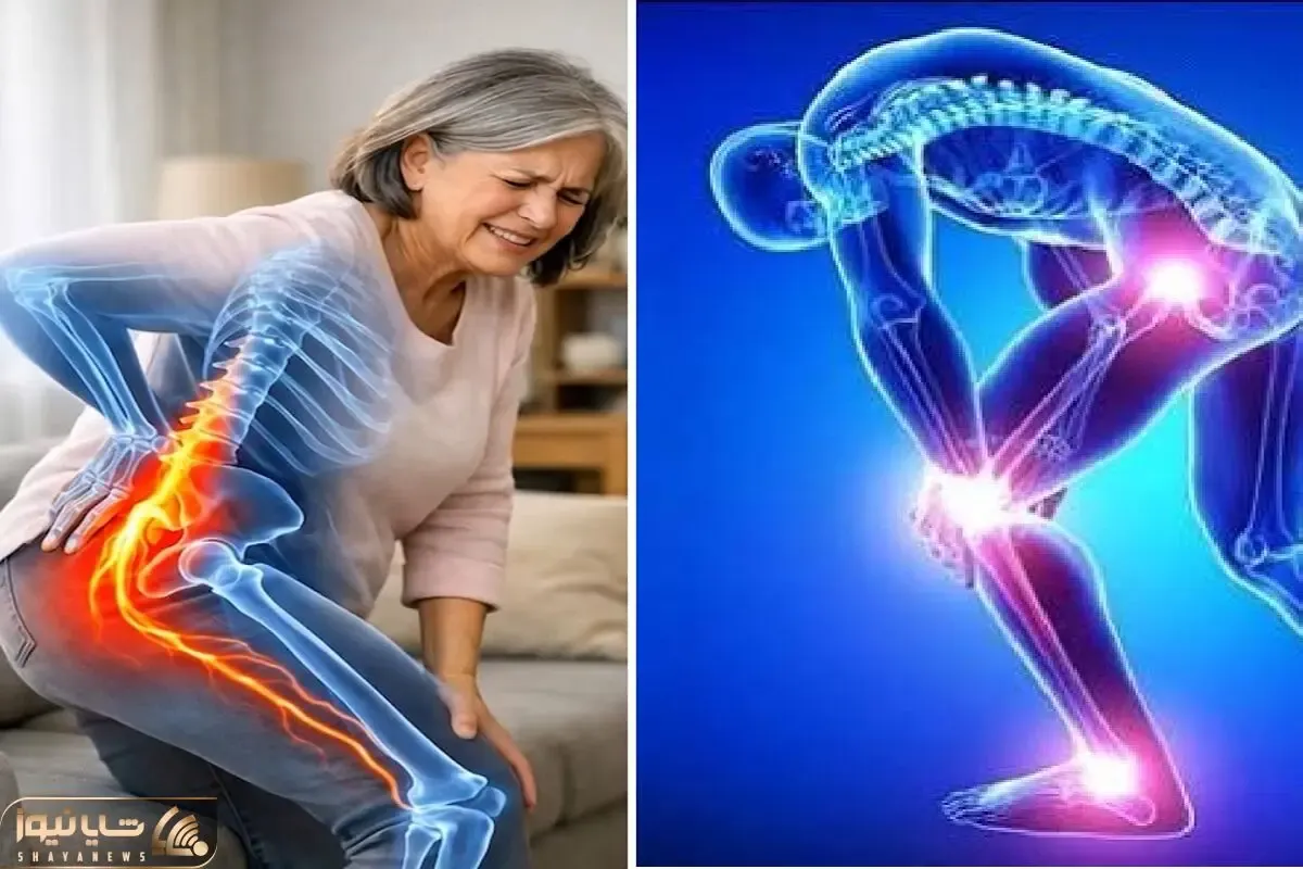 علائم سیاتیک و حرکات اصلاحی برای درمان؛ درد برات زندگی نزاشته یاد بگیر خودت حلش کنی