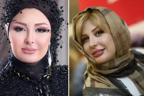 تغییر خفن نیوشا ضیغمی بعد عمل!