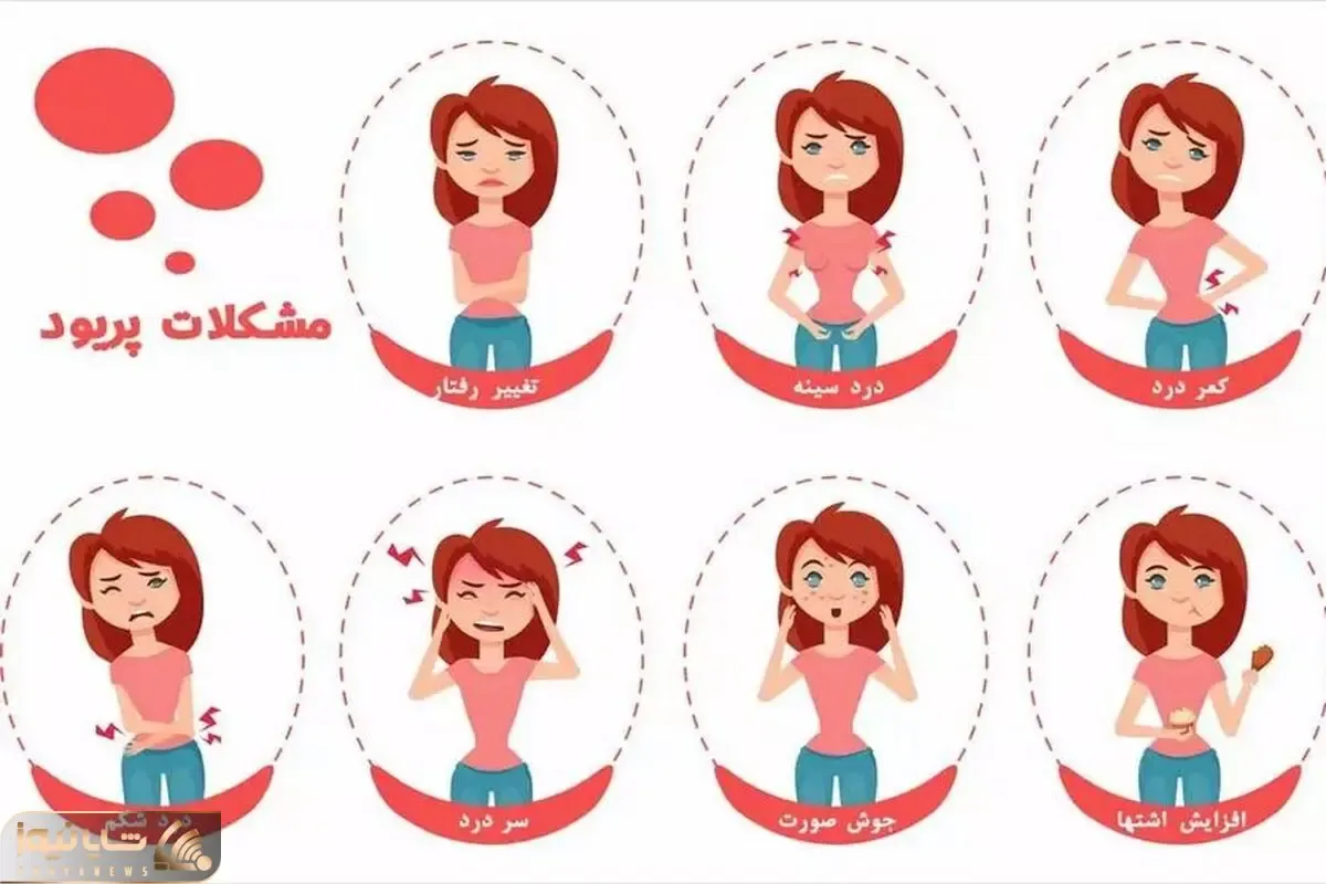 علائم کیست تخمدان؛ فهمیدن وجود کیست و بیماری از روی درد عادت ماهانه در دختران باکره