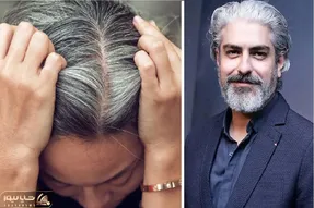 آلودگی هوا فقط ریه‌ها را ضعیف نمی‌کند، موها را هم سفید می‌کند!