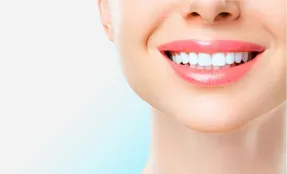 همه چیز درباره لمینت دندان؛ از مزایا تا عوارض آن
