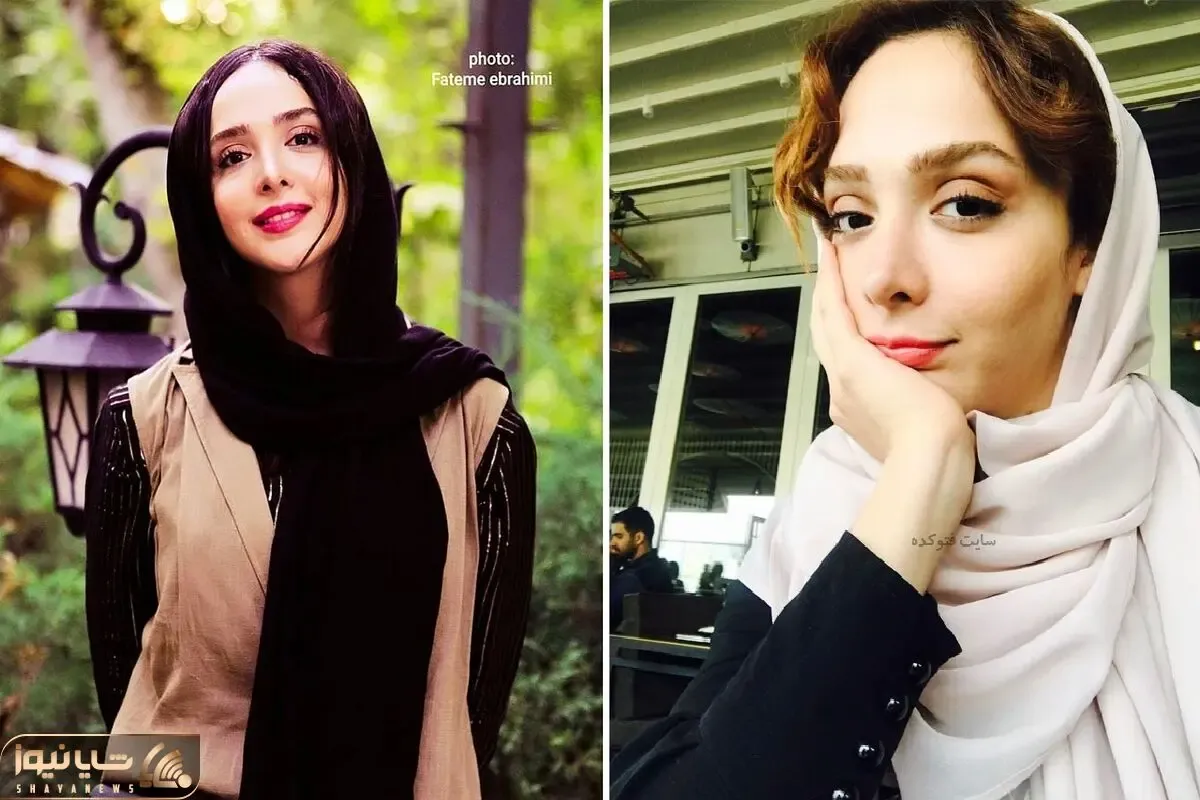سلفی زیبا و رمانتیک المیرا دهقانی با همسرش از دید عکاسای خفن؛ فیس خوب بعد عملشو!
