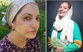 تغیر چهره زیاد