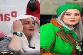 نعیمه نظام دوست و ربایش با بنز توسط اسکویید گیم / عمل غبغب و موهایی که رنگ دندون شد