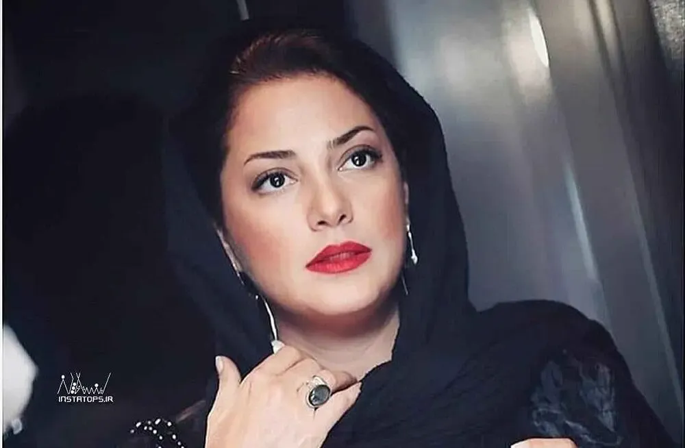 عکسی باور نکردنی از طناز طباطبایی قبل از عمل زیبایی