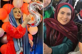 چهره پُررر پروتز 