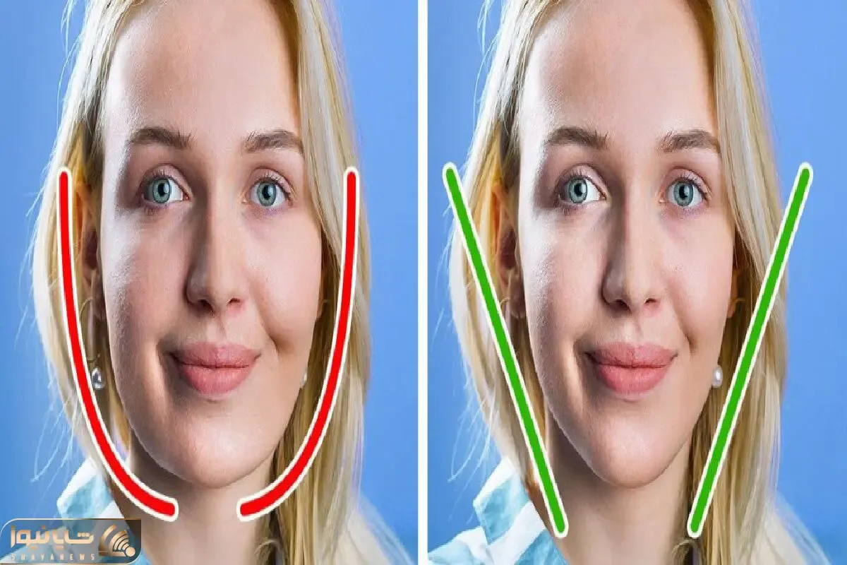رفع ورم صبحگاهی صورت بعد از خواب / برا تو که وقتی بیدار میشی انگار زنبور نیشت زده