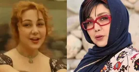 (عکس) بهنوش بختیاری با لب هایی شتری و نامتعارف !