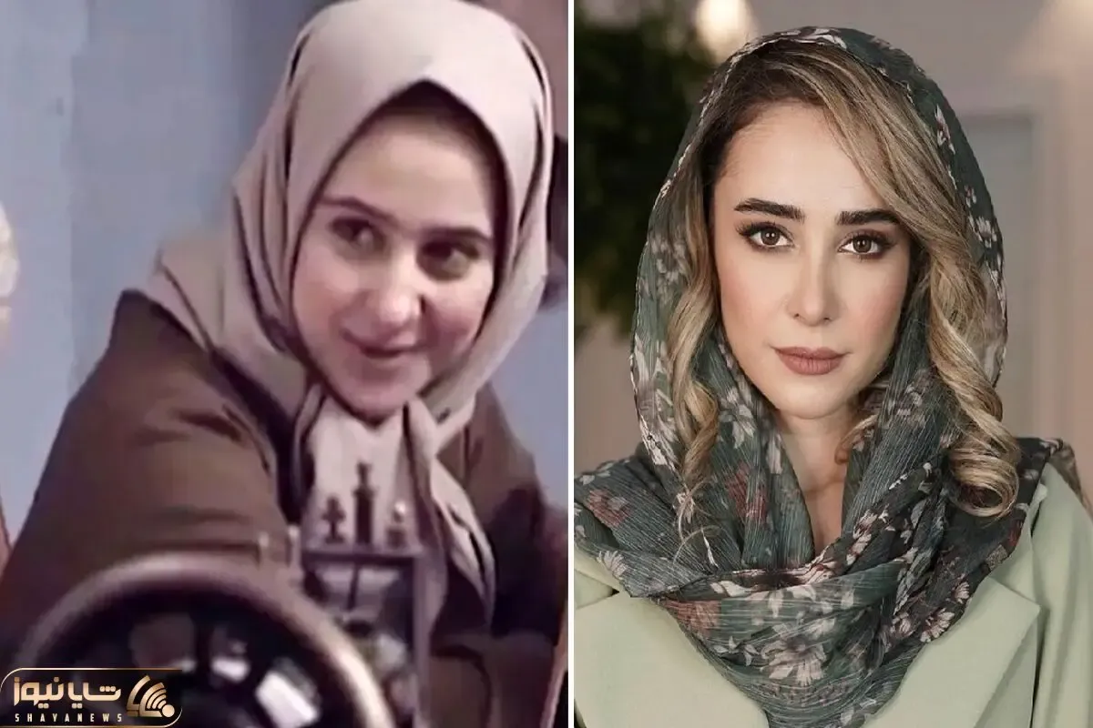 فرق الناز حبیبی چهل ساله با نوزده ساله / عمل بینی بعد از سریال روزگار قریب جادو کرد