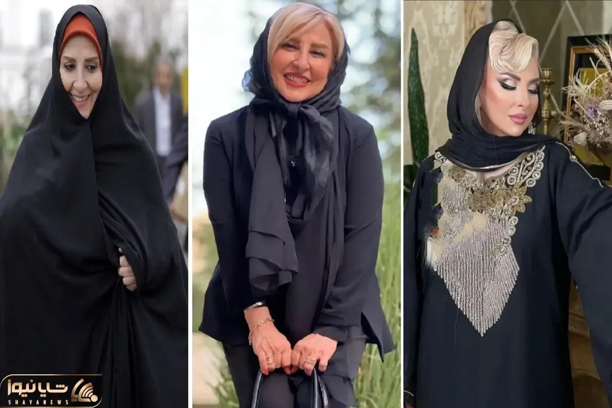 مرجانه گلچین ژلو یه جور رَوونه لباش کرد که انگار زنبور نیشش زده؛ نیوفیس خانوم ستودنیه