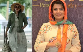 (عکس) تغییر چهره باور نکردنی خانم بازیگر!