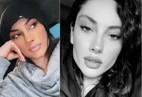 خودنمایی ترلان پروانه با چشم های گربه ای و لب های شتری اش!