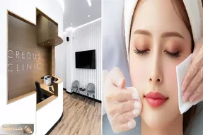 بهترین مرکز پاکسازی پوست در تهران / پوست مثل کیوی زبر و چاله چوله بده آینه تحویل بگیر