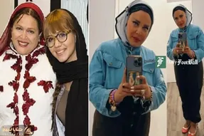 تولد عجیب الخلقه ای که 