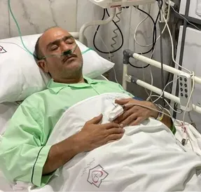 علت سکته 